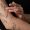 Aftercare